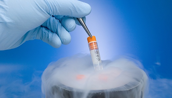 10 Steps of Embryo Transfer