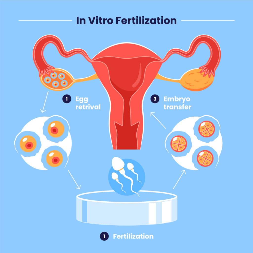 A Concise Overview of the IVF Treatment Process