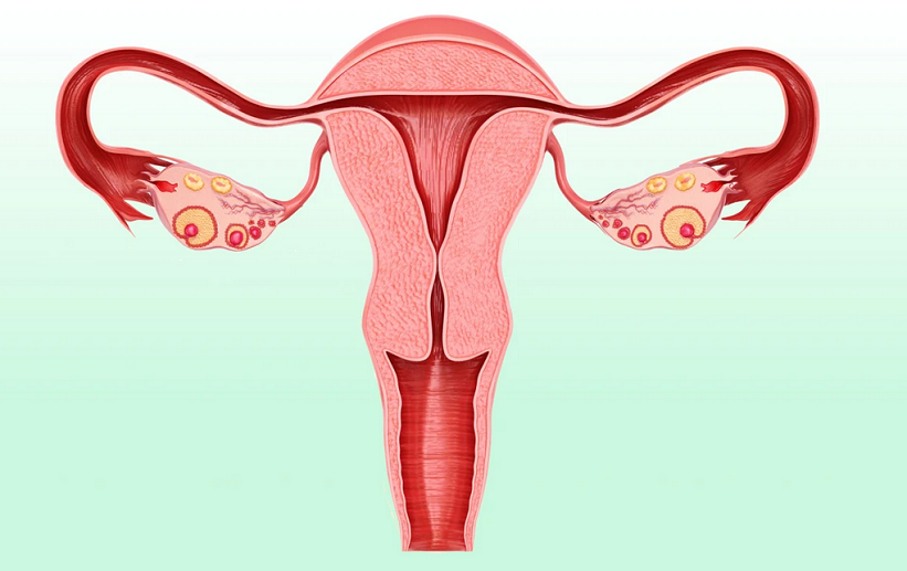Understanding the Signs of Infection After Tubal Ligation